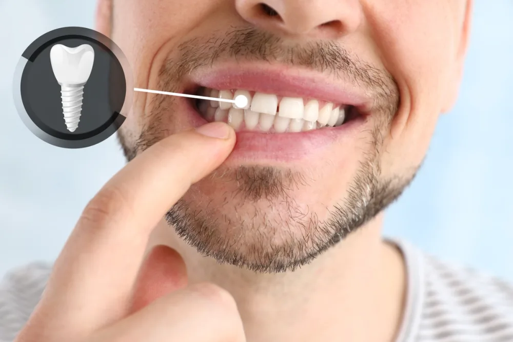 A patient smiling and pointing toward a tooth