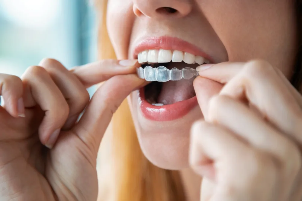 A patient holding a clear dental aligner